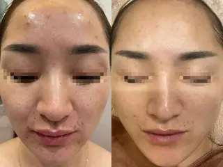 マツエク・マツパ 愛維美水光美肌専門店所属・愛維美水光美肌専門店 メンズレディースokのエステ・リラクイメージ