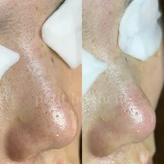 槙谷 あさみのエステ・リラクイメージ