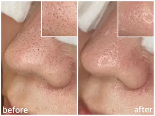 韓国肌管理 【毛穴専科】のエステ・リラクイメージ