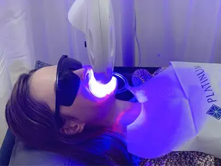 White Berry SELF BEAUTY SALON所属・セルフホワイトニング 🦷口元垢抜け✨のその他イメージ