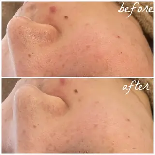 メンズ メナード岐阜市茜部 杉浦のエステ・リラクイメージ