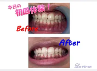 セルフホワイトニングサロン　ラヴィアン所属・ホワイトニングサロン La vie enのその他イメージ