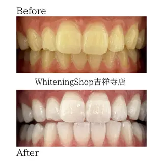 ホワイトニング ショップ吉祥寺店のエステ・リラクイメージ