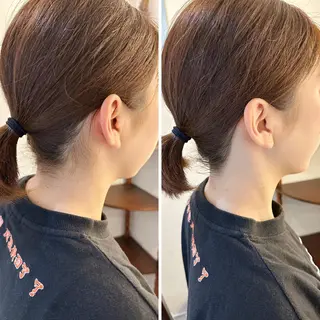 うなじ脱毛/美肌脱毛 LABELのエステ・リラクイメージ