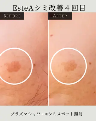 シミ毛穴|眉Wax THE  flowのエステ・リラクイメージ