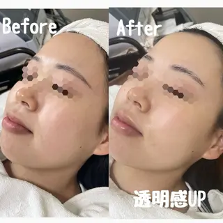 Surien 水脇ゆうのその他イメージ