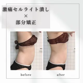 小顔矯正専門店 【RED】池田のエステ・リラクイメージ