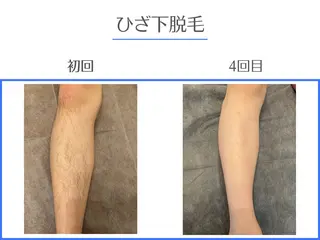 ホワイトニング/脱毛 専門店エクシア岡崎店のその他イメージ