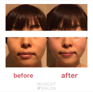 マスカットサロン所属・マスカットサロン 小野寺のエステ・リラクイメージ