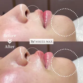 フェイシャルワックス KANAKOのエステ・リラクイメージ