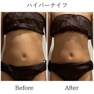 LiLL by Andre beauty所属・LiLL 熊本のエステ・リラクイメージ