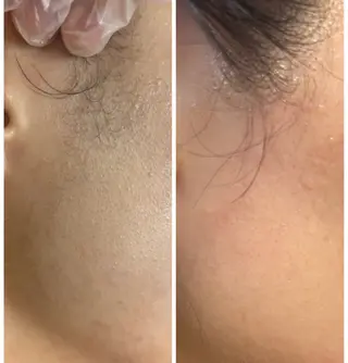 beauty  salon sorelle所属・産毛角質ケア/艶肌 フェイシャルワックスのエステ・リラクイメージ