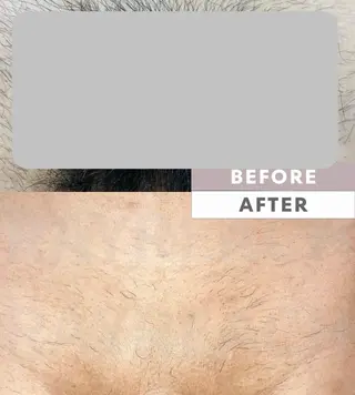 ELEGANCE所属・メンズ脱毛サロン BRIGHTのエステ・リラクイメージ