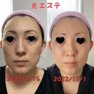 Rim リムのマツエク・マツパデザイン