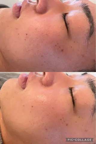 Lavi&所属・肌質改善サロン Ｌａｖｉ＆のその他イメージ