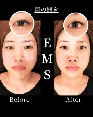 恵比寿/小顔/矯正 美容整体師⭐︎Aiのエステ・リラクイメージ