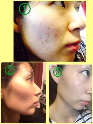 at home エステLumiereのエステ・リラクイメージ