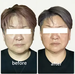 ルコナビューティ所属・小顔・歪み専門　井元 朋子のエステ・リラクイメージ