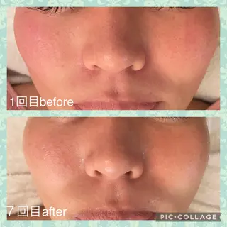 Serenity salonのエステ・リラクイメージ