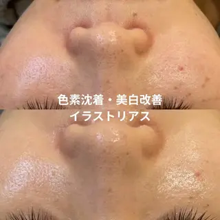 【LEPUS】レプス nishimoriのエステ・リラクイメージ