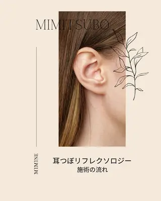 mimine エメラルド式耳つぼのその他イメージ