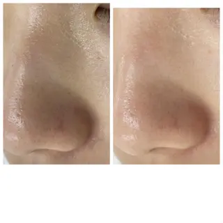 CEサロンblanc bebe所属・高村 有紀のエステ・リラクイメージ