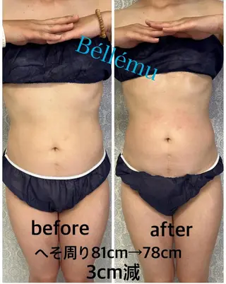 Salon de Béllému所属・Béllému ﾍﾞﾙｴﾐｭ　あおいのエステ・リラクイメージ