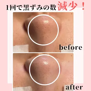 ピーリング専門店 Belluteのエステ・リラクイメージ