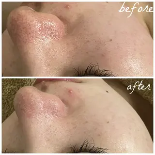 メンズ メナード岐阜茜部 杉浦のエステ・リラクイメージ