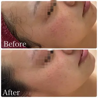 【代謝×免疫UP】お肌と身体のオールハンド専門店estheya sign所属・オールハンド専門店 【リンパ×ヘッド】のエステ・リラクイメージ