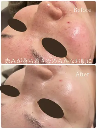 Lutan Richeさいたま店所属・ルタンリッシュ さいたま店のエステ・リラクイメージ