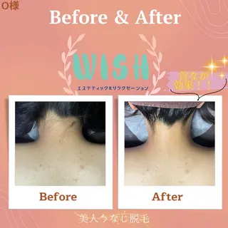 WISH 美肌脱毛のプロ！須藤のエステ・リラクイメージ