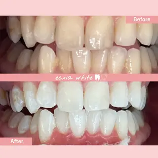 セルフホワイトニング エクシア札幌琴似店のその他イメージ