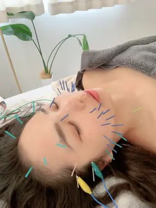 美容鍼・鍼灸専門❤✨ 近藤めぐみのエステ・リラクイメージ