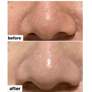 アロマ•ピーリング SalonYokoのその他イメージ