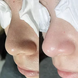 C. Lのマツエク・マツパデザイン