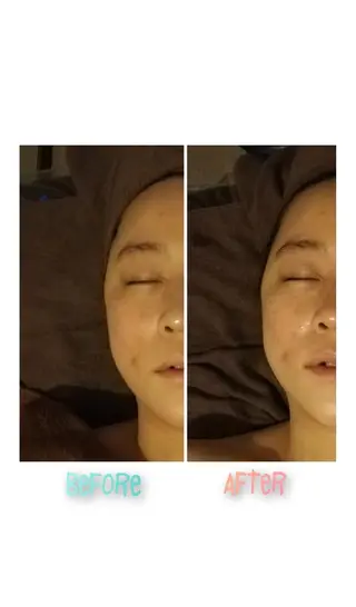 肌管理専門！BACI 加盟店LUANAのエステ・リラクイメージ