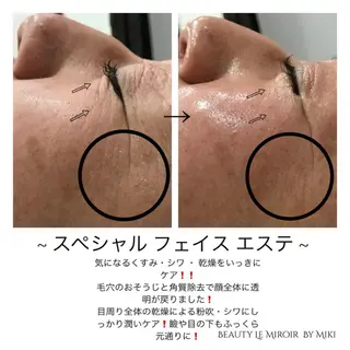 ビューティー ミロワールのエステ・リラクイメージ