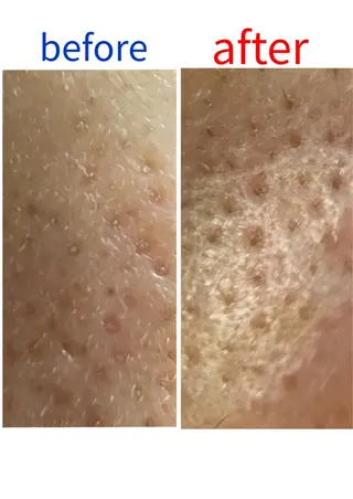 デアイム川口前川所属・エイジング肌質改善 サロンプレジールのエステ・リラクイメージ