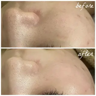 メンズ メナード岐阜市茜部 杉浦のエステ・リラクイメージ