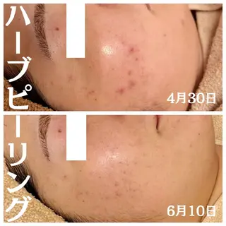 フェイシャル専門サロ ン　ERINのエステ・リラクイメージ