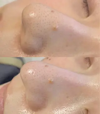 メンズ salonLADYSTYLE所属・稲嶺 美華のエステ・リラクイメージ