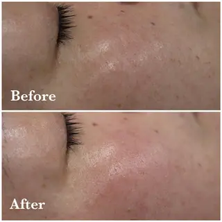 ANRIRE (アンリール)のエステ・リラクイメージ