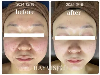 RAYVIS 郡山店のエステ・リラクイメージ