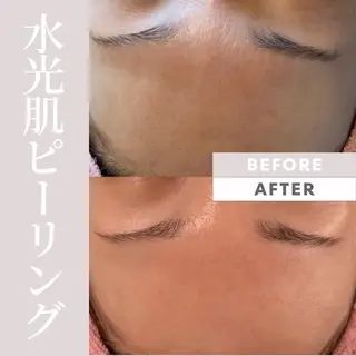 Purua beuty所属・月1肌管理 RINAのエステ・リラクイメージ