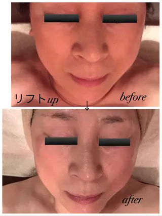 フェアリーローズ所属・fairyrose organicエステのエステ・リラクイメージ