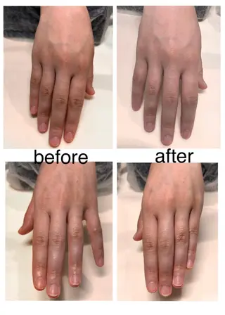 ネイル 毛穴改善/脱毛 ネイル　川上久仁子のエステ・リラクイメージ