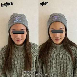 うなじ脱毛/美肌脱毛 LABELのエステ・リラクイメージ