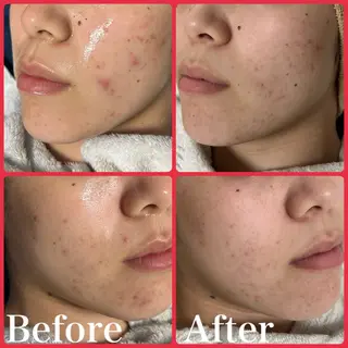 skin make salon -Olu's-所属・毛穴・肌質改善サロン ✨Tomaのその他イメージ