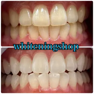 ホワイトニング ショップ吉祥寺店のエステ・リラクイメージ